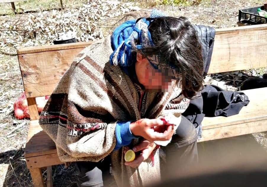 NUEVA IMPERIAL: Pacos criminales balearon a comuneros mapuche y secuestraron a uno de ellos